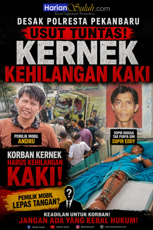 Desak Polresta Pekanbaru kejadian di Riau Kernek Kehilangan Kaki, Sopir Diduga Tak Punya SIM, Pemilik Mobil Lepas tangan