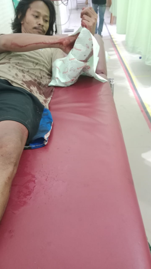 Warga Mayangsari Luka Parah Diduga Dibacok Pihak Keamanan PT. Sari Lembah Subur